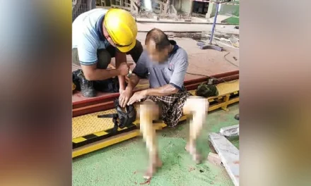 Worker suffers burns on legs after falling into cauldron of molten zinc