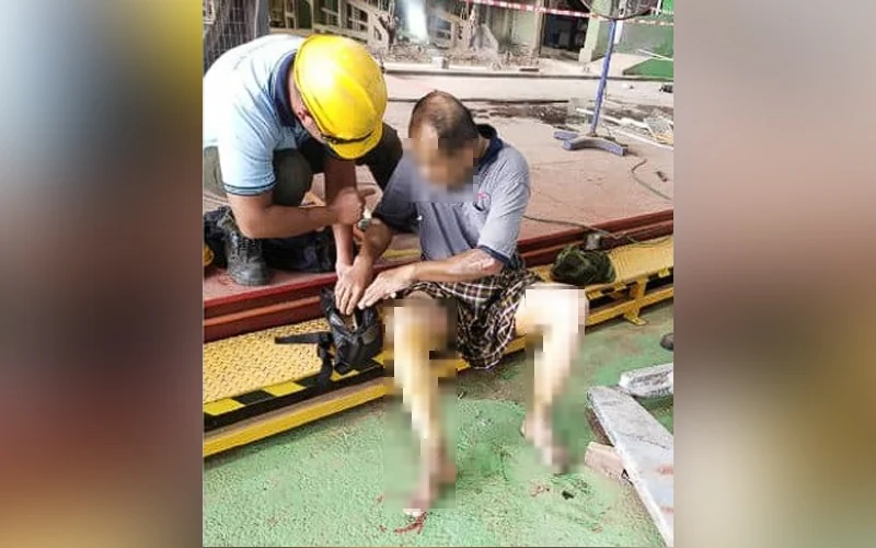 Worker suffers burns on legs after falling into cauldron of molten zinc